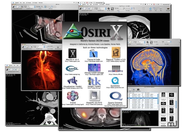 osirix mac