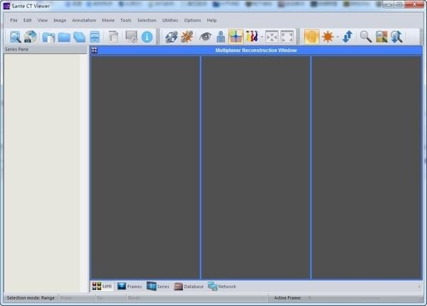 Sante CT Viewer