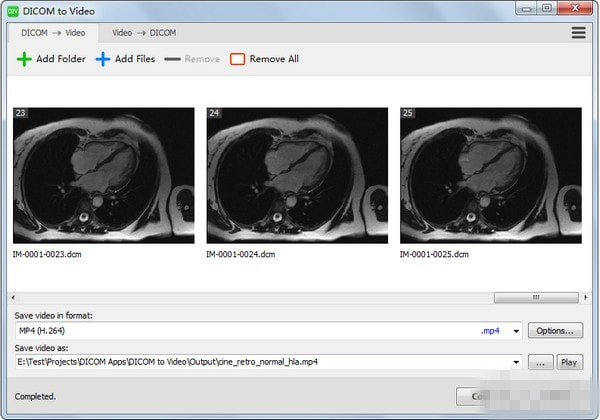 DICOM to Video下载
