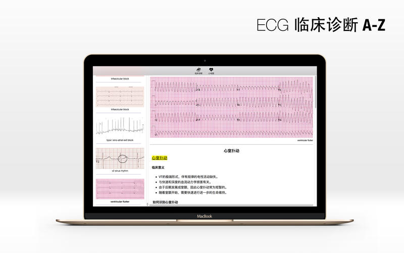 ECG Mac版 V1.0 官方版图3