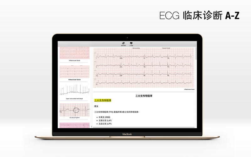 ECG Mac版 V1.0 官方版图2
