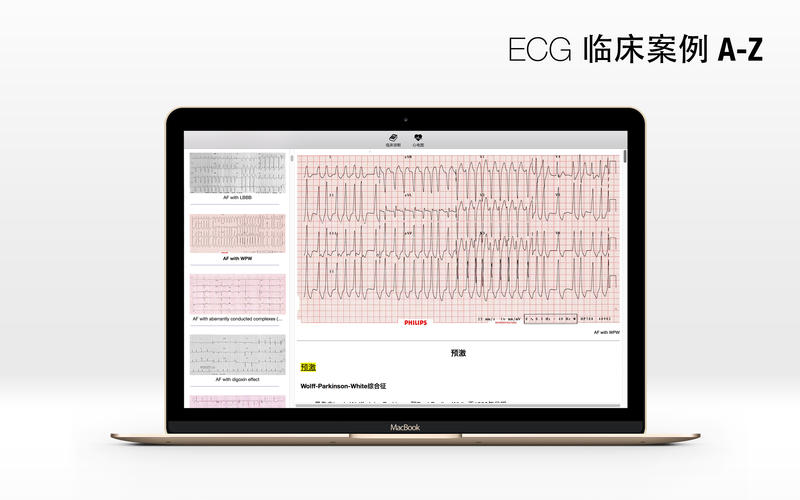 ECG Mac版 V1.0 官方版图5