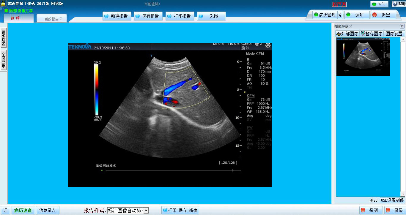 巨渺超声影像工作站网络系统下载 2017 免费版图1