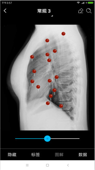 轻盈医学下载 v5.3.0 最新版图2