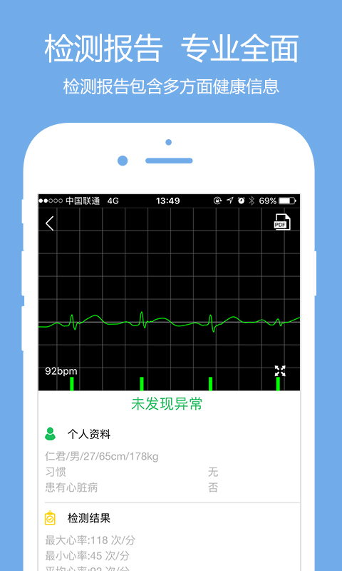 极简心电app