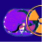 Sante CT Viewer